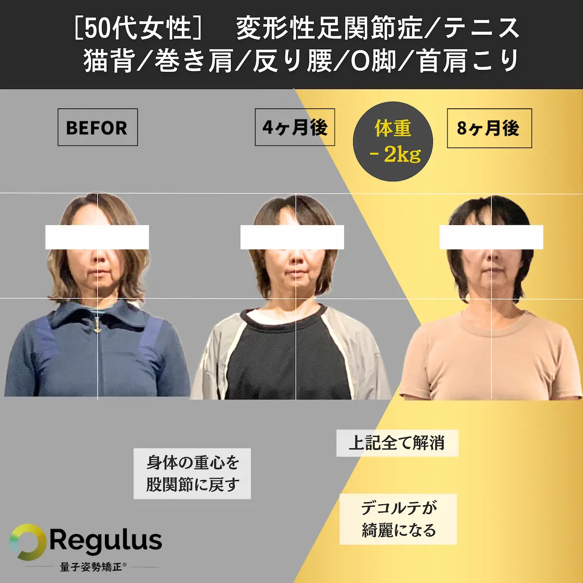 [50代女性]変形性足関節症／テニス／猫背／巻き肩／反り腰／O脚／首肩凝り