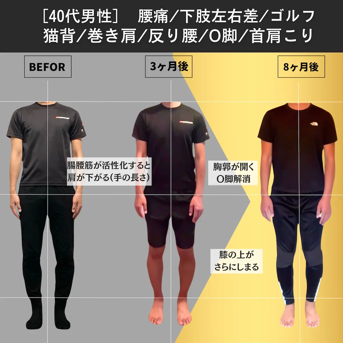 [40代男性]腰痛／下肢左右差／ゴルフ／猫背／巻き肩／反り腰／O脚／首肩凝り