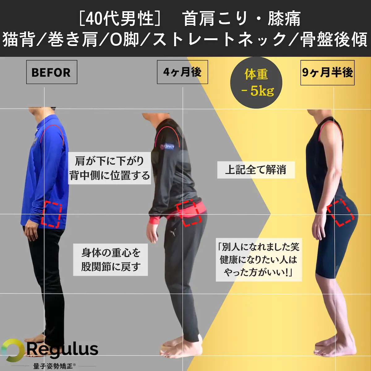 [40代男性]首肩凝り・腰痛／猫背／巻き肩／O脚／ストレートネック／骨盤後傾