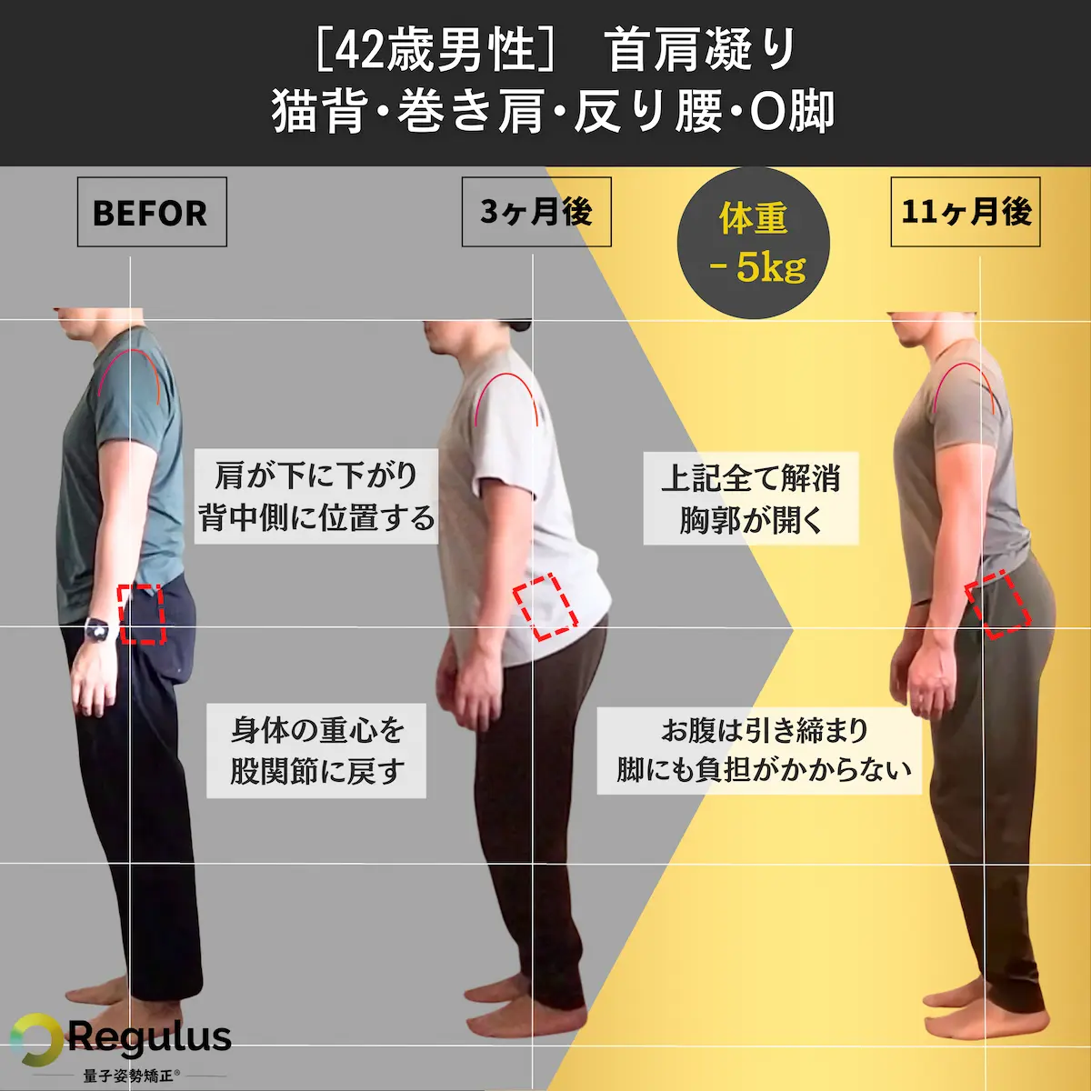 [42歳男性]首肩凝り・猫背・巻き肩・反り腰・O脚