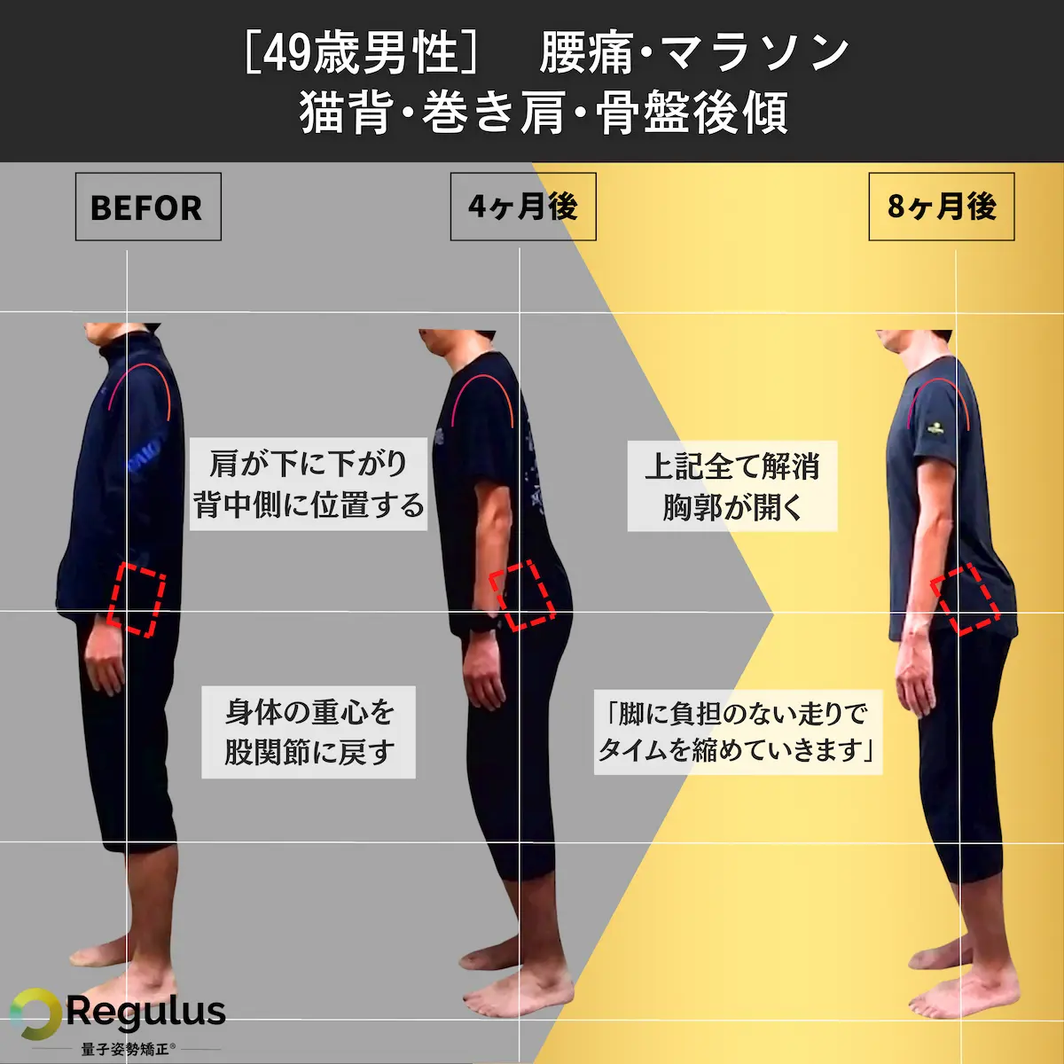 [49歳男性]腰痛・マラソン・猫背・巻き肩・骨盤後傾