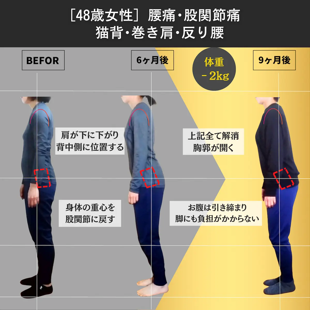 [48歳女性]腰痛・腰関節痛・猫背・巻き肩・反り腰