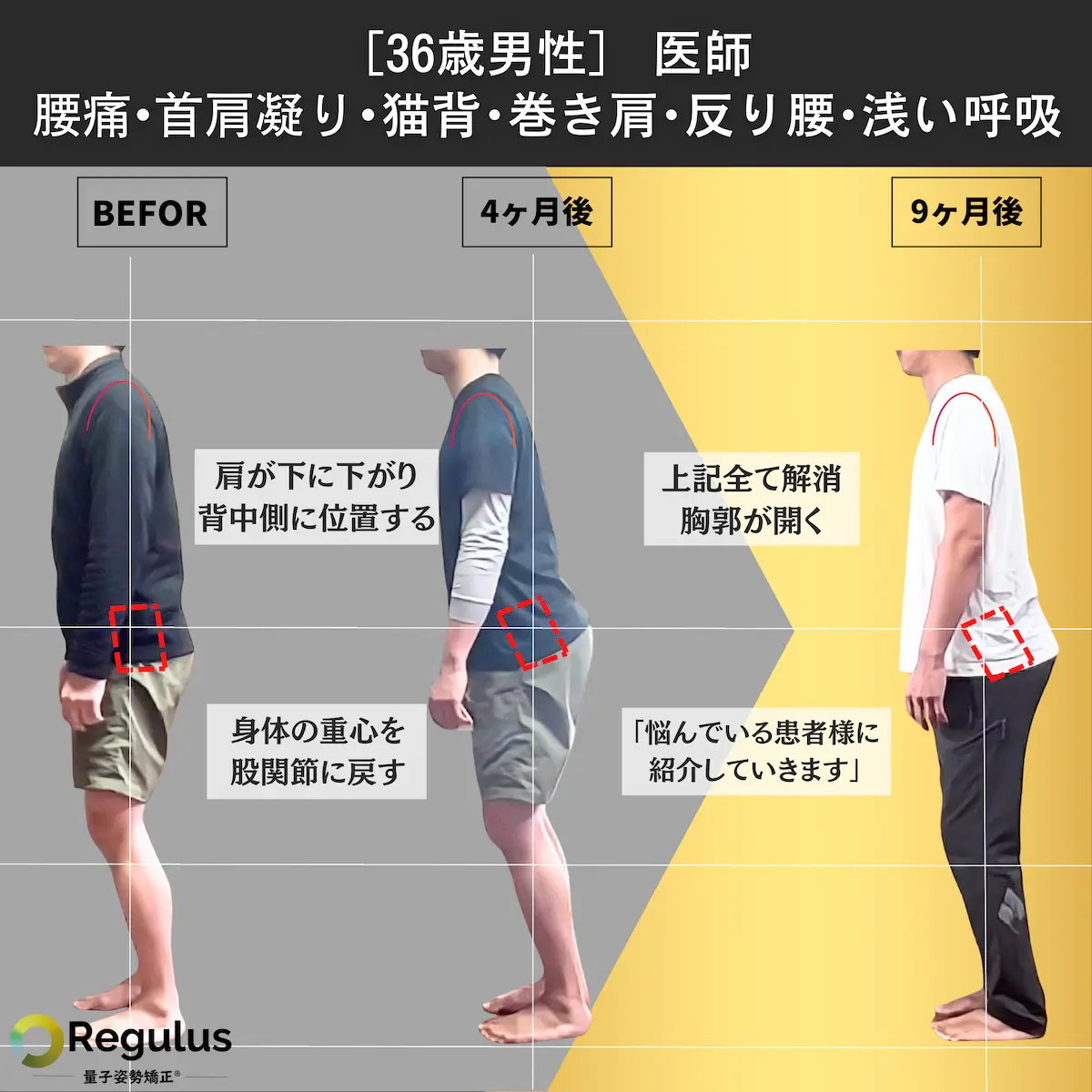 [36歳男性]医師　腰痛・首凝り・猫背・巻き肩・反り腰・浅い呼吸