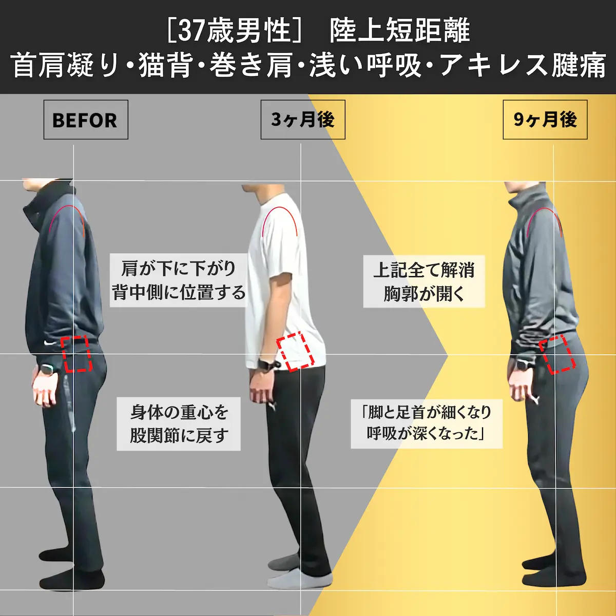 [37歳男性]陸上短距離　首肩凝り・猫背・巻き肩・浅い呼吸・アキレス腱痛