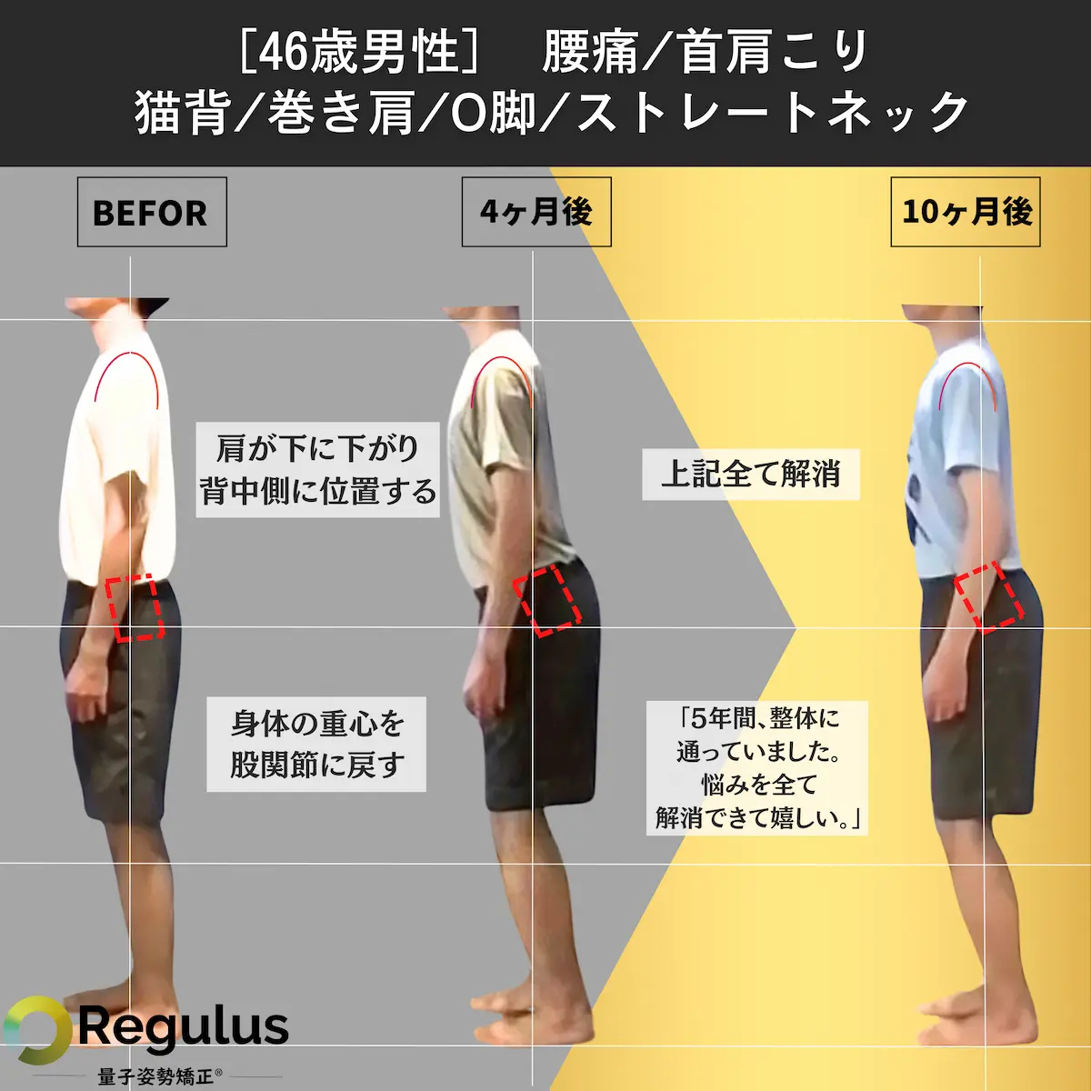 [46歳男性]腰痛／首肩こり／猫背／巻き肩／O脚／ストレートネック