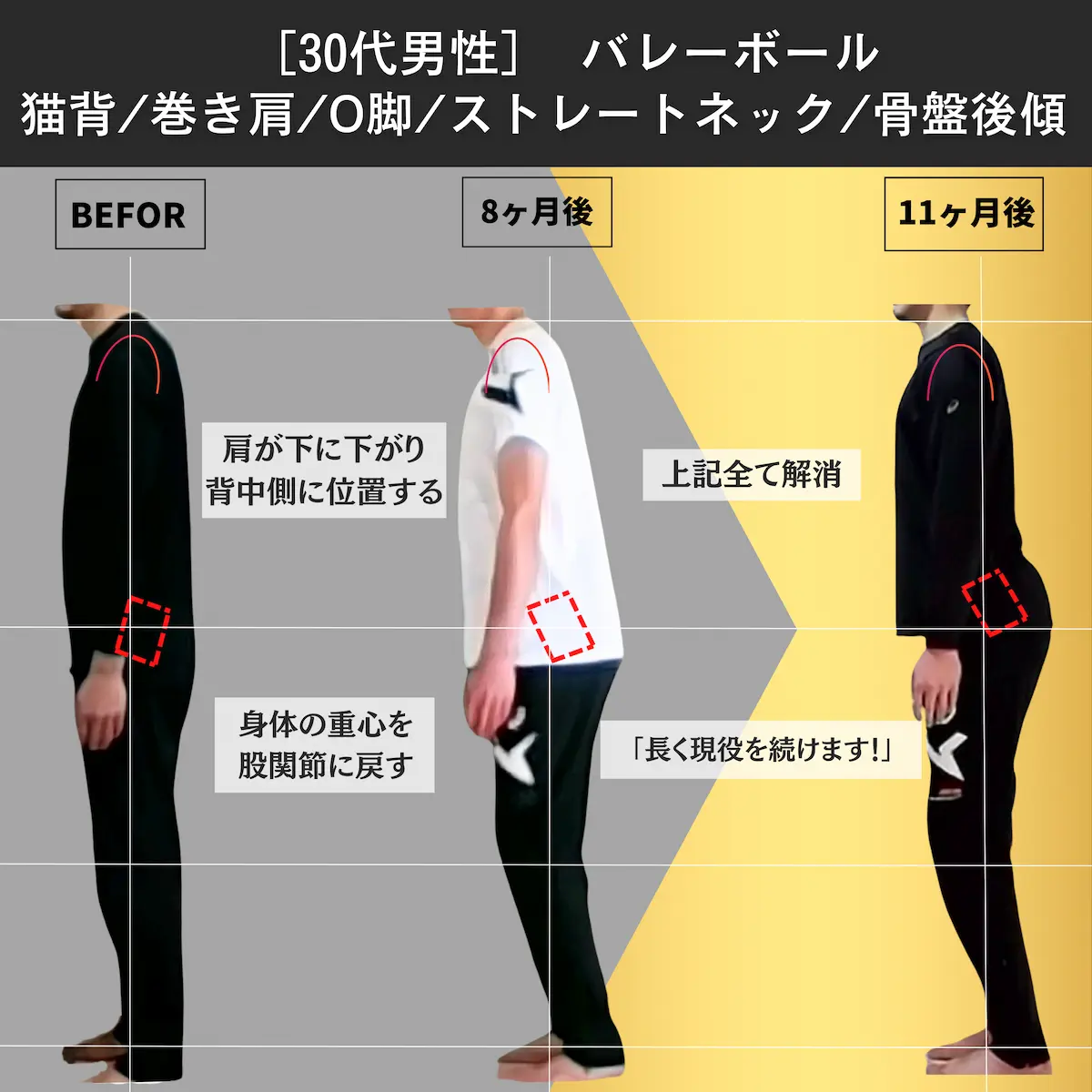 [30代男性]バレーボール　猫背／巻き肩／O脚／ストレートネック／骨盤後傾