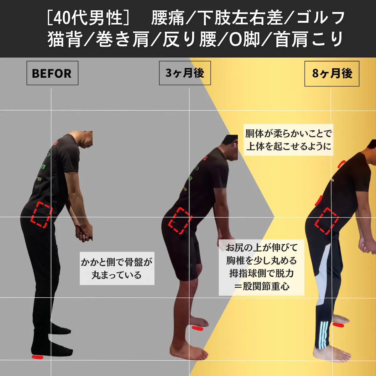 [40代男性]腰痛／下肢左右差／ゴルフ／猫背／巻き肩／反り腰／O脚／首肩こり
