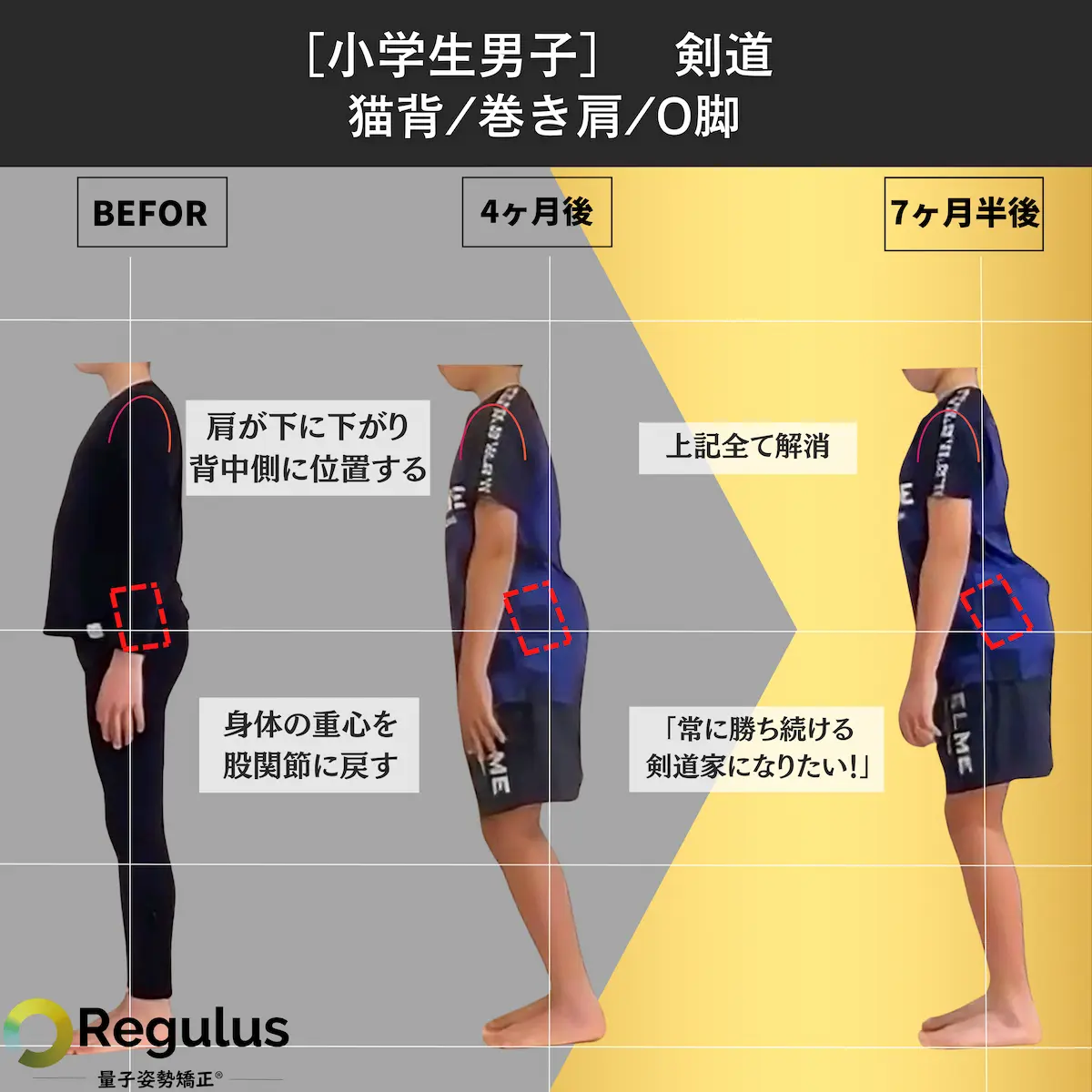 [小学生男子]剣道　猫背／巻き肩／O脚