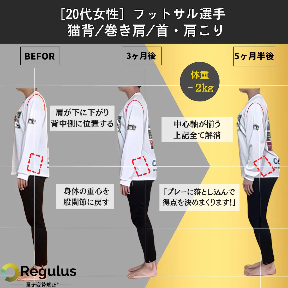 [20代女性]フットサル選手　猫背／巻き肩／首・肩こり