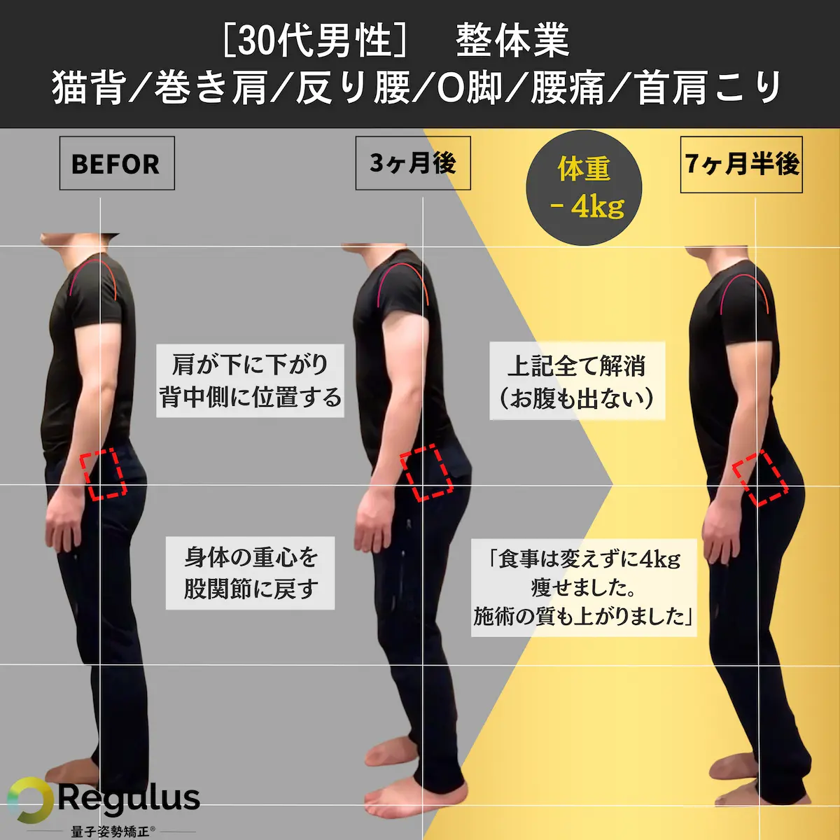 [30代男性]整体業　猫背／巻き肩／反り腰／O脚／腰痛／首肩こり