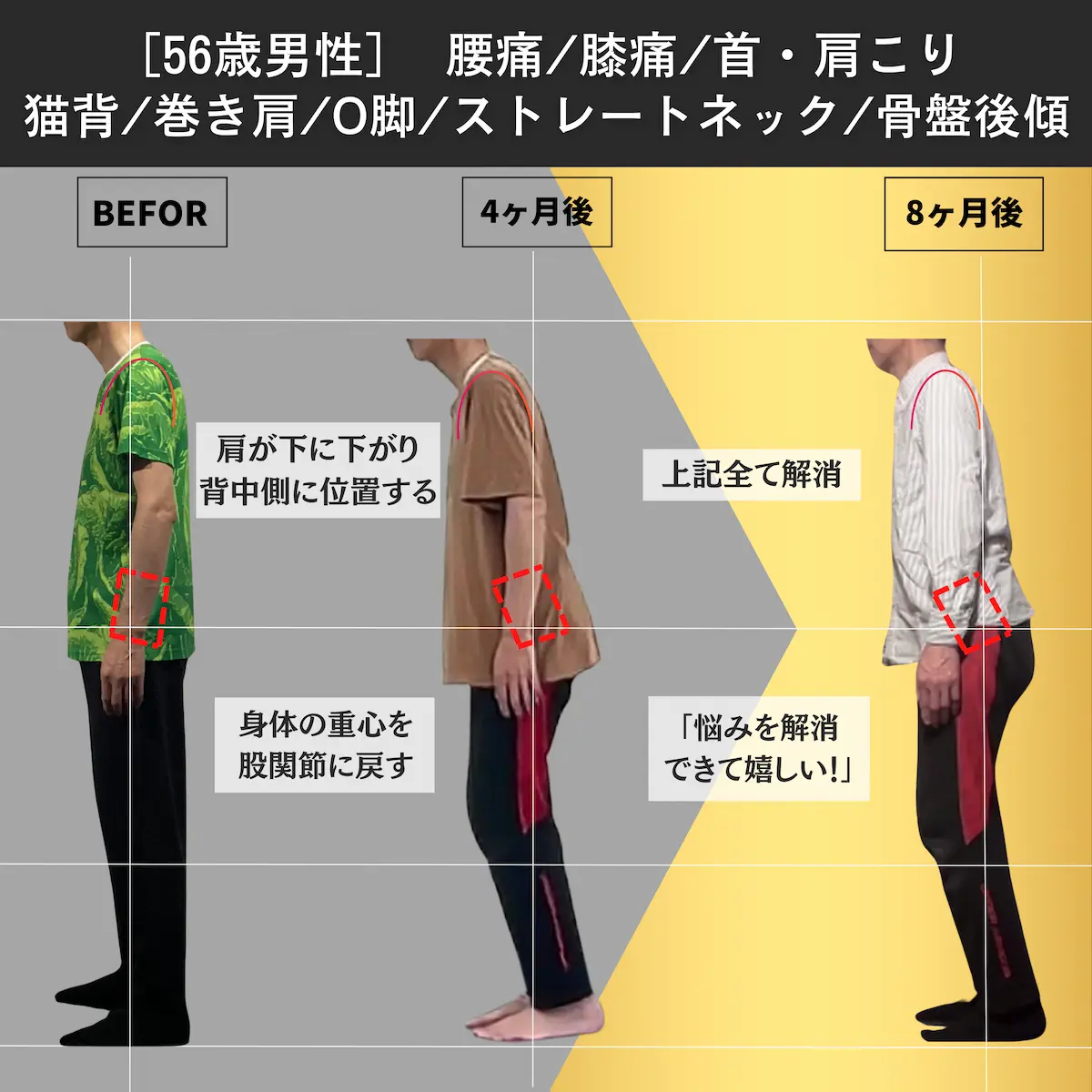 [56歳男性]腰痛／膝痛／首肩こり／猫背／巻き肩／O脚／ストレートネック／骨盤後傾