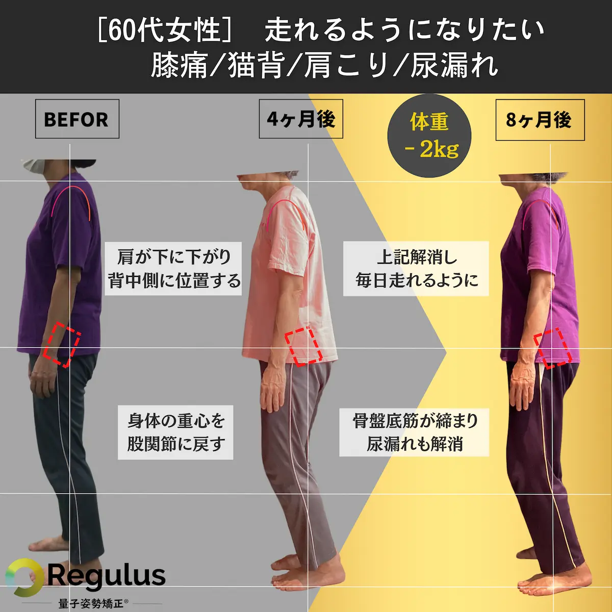 [60代女性]走れるようになりたい　膝痛／猫背／肩こり／尿漏れ